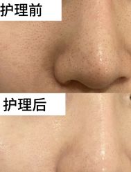 -香榭丽舍·海菲秀·皮肤管理痘敏肌修护