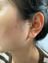 -北京美痣堂古方祛痣斑疣瘊