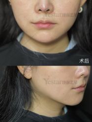 -Yestar艺星整形美容医院