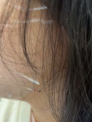 -美瑞莎创美医疗美容