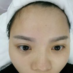 体验前-深圳春天阳光医院·轮廓抗衰中心