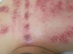 -惠康盲人按摩(银泉大道店)