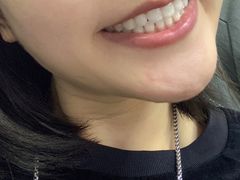 -同步齿科·数字化正畸种植口腔中心(前山店)