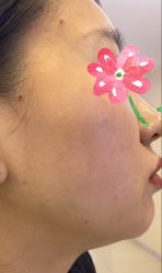 -长沙雅美医疗美容医院