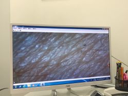 皮肤测试-痘博士天津·全国连锁祛痘机构