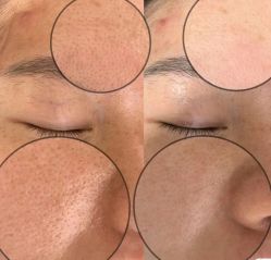 点击看大图 -SKIN79皮肤管理中心