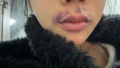 -苏州卫康美容医院