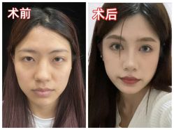 -素美医疗美容·西南眼鼻整形·修复基地