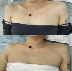 -LUNA皮相美·骨相美高级美感