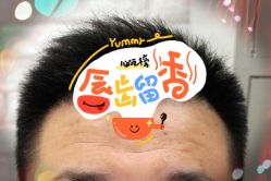 -大麦微针植发全国连锁