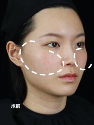 -广州美莱医疗美容医院
