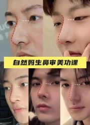 -北京米扬丽格医疗美容·联合丽格鼻整形中心