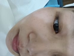 体验前-德媛医疗美容