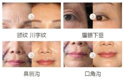 年轻化对比案例-加减美医美连锁品牌