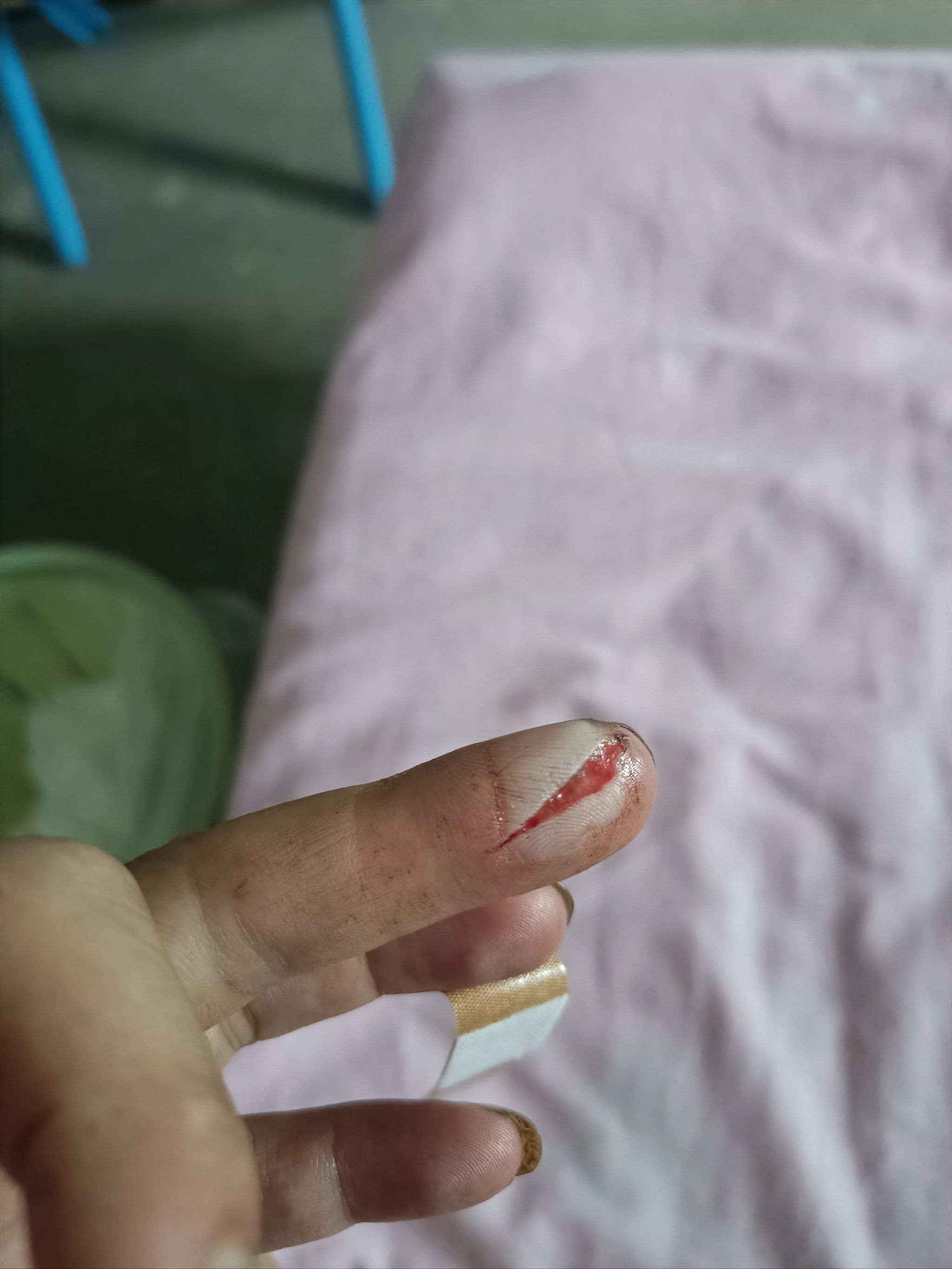 手指小伤不哭泣