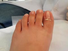 -世龙世家灰指甲鸡眼脚气甲沟炎跖疣护理(通州店)