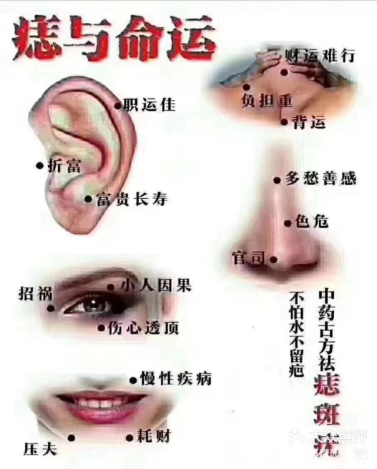 【痣缘宫释痣】<img class="emoji