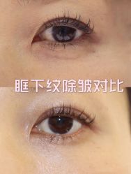 -上海漾颜医疗美容