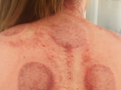 -理疗君·古法推拿姜疗SPA馆(东门店)