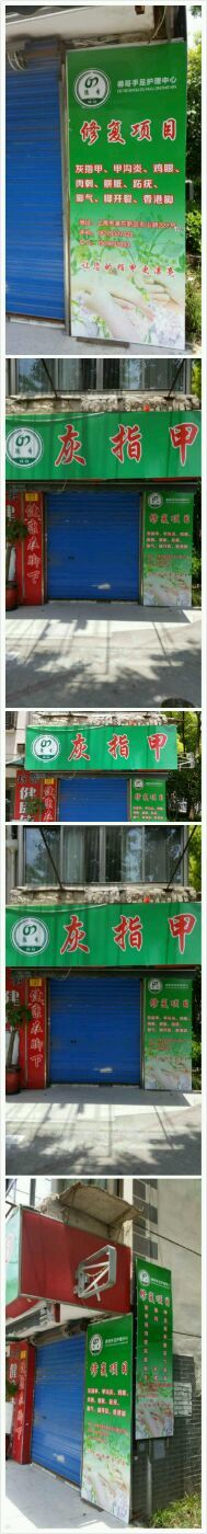 点击看大图 -德哥灰指甲脚气甲沟炎跖疣护理