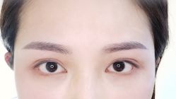 术后即刻-AYA FACE 微注颜·德式半永久定妆