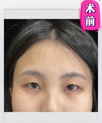 -素美医疗美容·西南眼鼻整形·修复基地