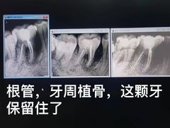 -同步齿科·数字化正畸种植口腔中心(珠海店)