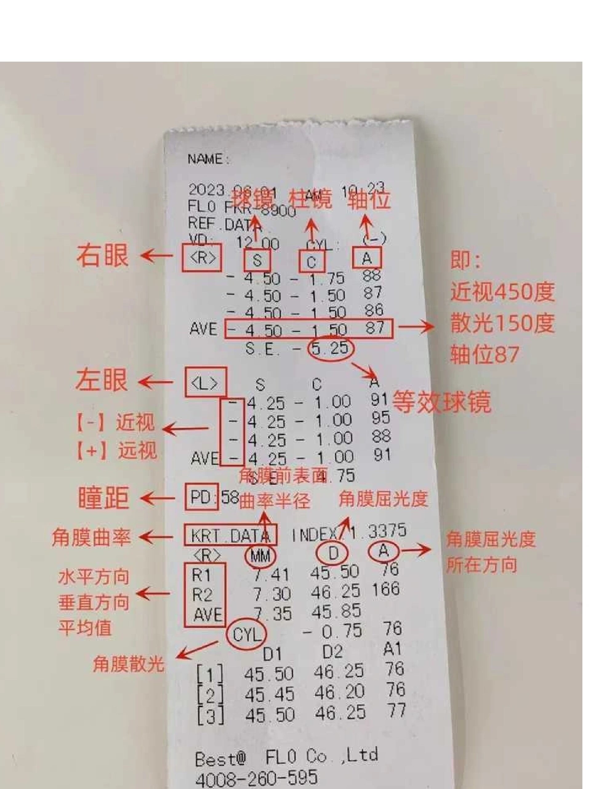 一文看懂孩子的视力筛查报告单