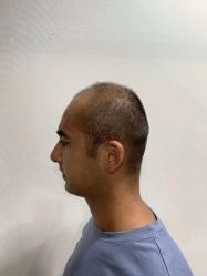 -发饰美男士增发补发假发定制店