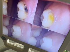-上海仁爱医院口腔科 · 种植