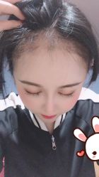 -大麦微针植发丨全国连锁