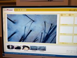 -丝客富脱发养发头皮馆