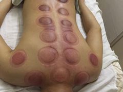 -安琪盲人按摩调理草本熏蒸馆(风和日丽店)