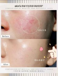 点击看大图 -SKIN79皮肤管理中心