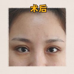 -素美医疗美容·西南眼鼻整形·修复基地