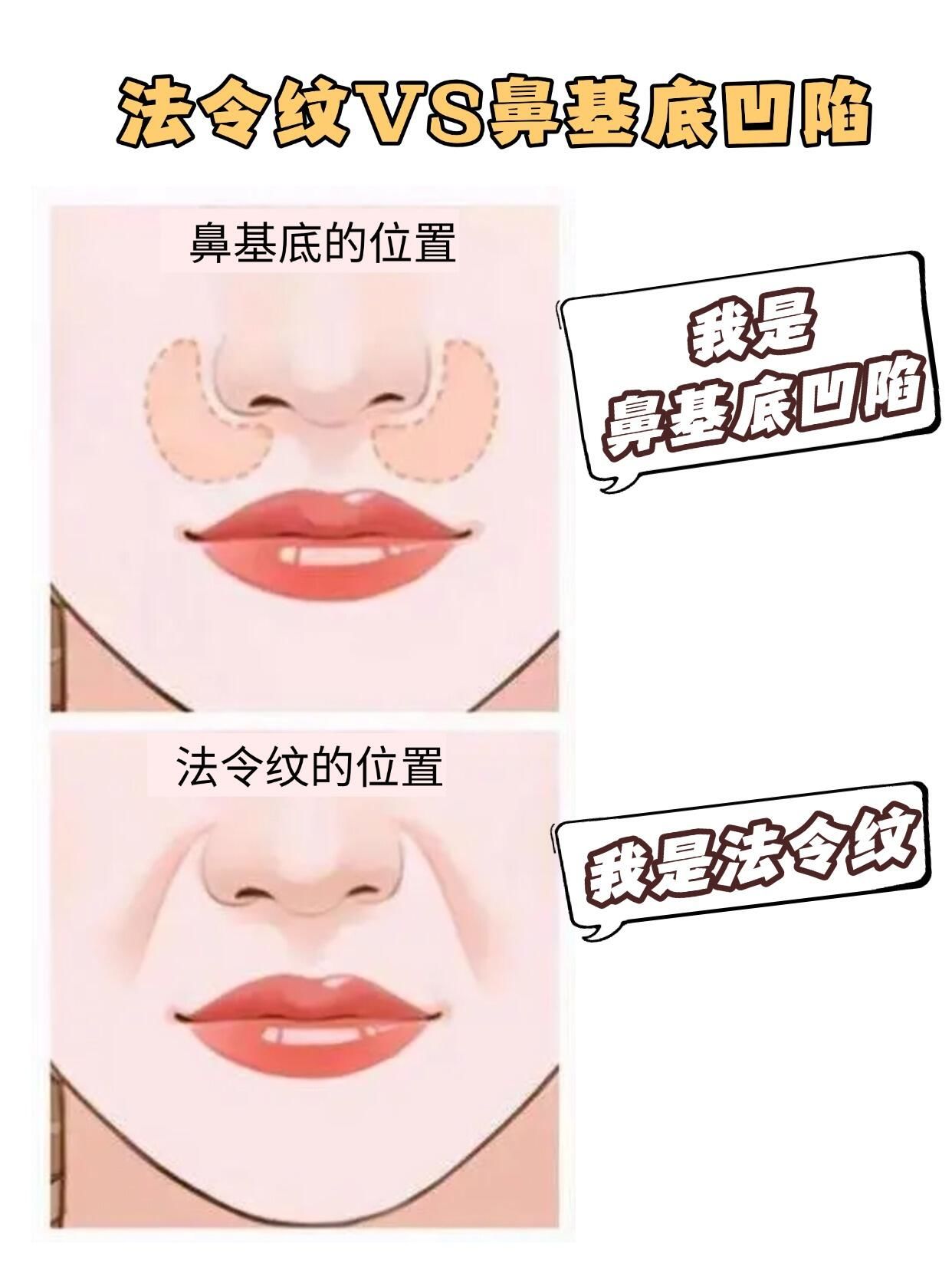 我看谁还不知道自己是什么类型的法令纹