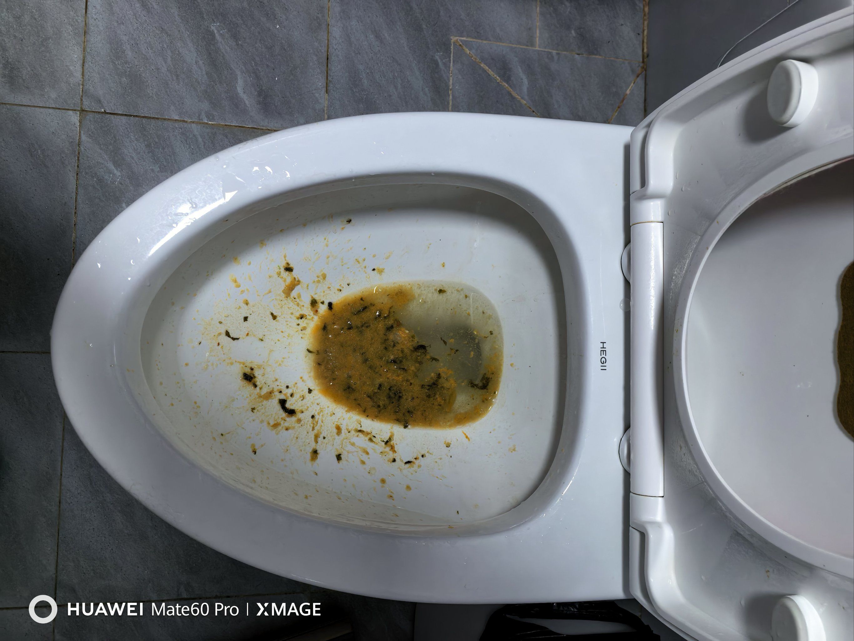 吃完上吐下泻的火锅你爱了吗🤮