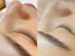 -美愈美肤MEIYU SKIN