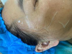 体验后-上海宏康医院·医疗美容科