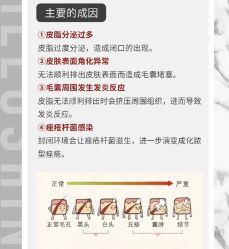 -苗方清颜痘肌研究所