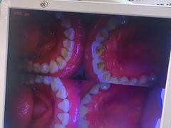 -爱牙联合口腔(门诊报销 海云庵店)