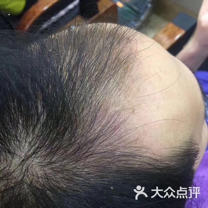 邱中乔生发黑发