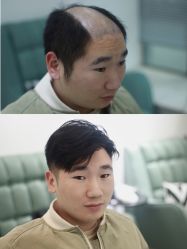 -发饰美男士增发补发假发定制店