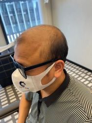 -唐风采假发补发定制