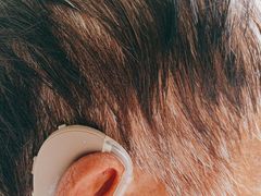 -自然之声助听器·呼吸机(公园路店)