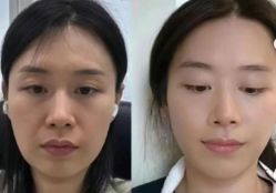 -上海伊莱美医疗美容医院
