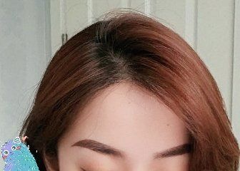 -大麦微针植发丨全国连锁