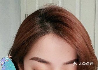 大麦微针植发丨全国连锁(宁波分院)图片