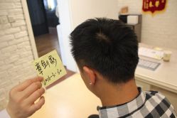 点击看大图 -大麦微针植发丨全国连锁