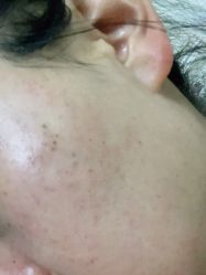 -亿美医疗美容·半岛大超炮官方授权店